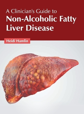 A Clinician's Guide to Non-Alcoholic Fatty Liver Disease book