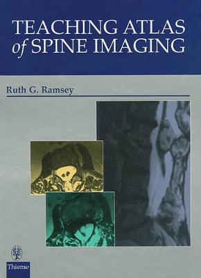 Teaching Atlas of Spine Imaging book