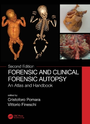 Forensic and Clinical Forensic Autopsy: An Atlas and Handbook by Cristoforo Pomara