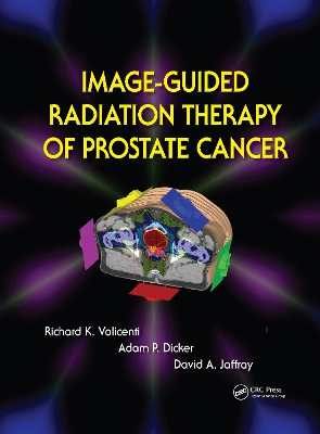 Image-Guided Radiation Therapy of Prostate Cancer book