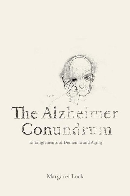 Alzheimer Conundrum book