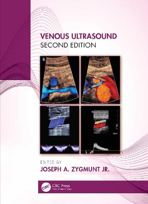 Venous Ultrasound book