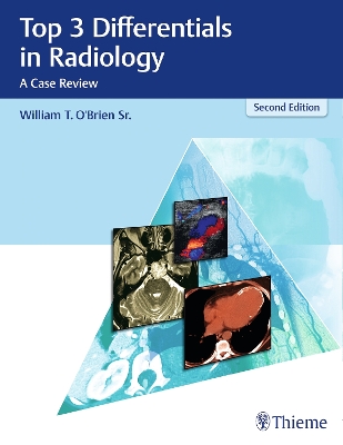 Top 3 Differentials in Radiology book