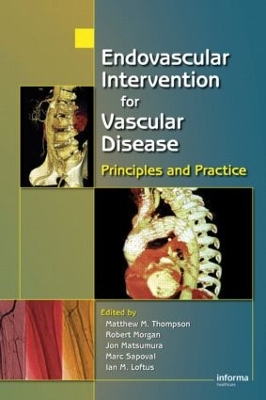 Endovascular Intervention for Vascular Disease book