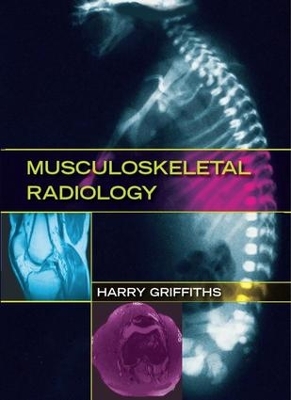 Musculoskeletal Radiology by Harry Griffiths