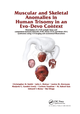 Muscular and Skeletal Anomalies in Human Trisomy in an Evo-Devo Context: Description of a T18 Cyclopic Fetus and Comparison Between Edwards (T18), Patau (T13) and Down (T21) Syndromes Using 3-D Imaging and Anatomical Illustrations book