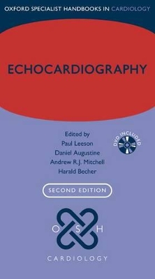 Echocardiography by Paul Leeson