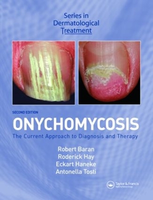 Onychomycosis: The Current Approach to Diagnosis and Therapy by Antonella Tosti
