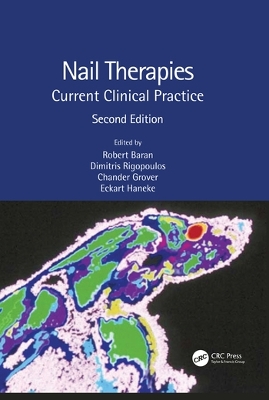 Nail Therapies: Current Clinical Practice book