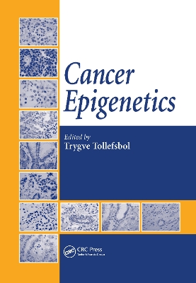 Cancer Epigenetics by Trygve Tollefsbol
