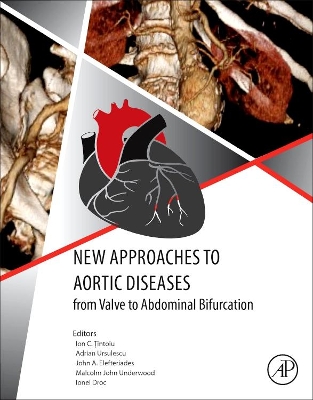 New Approaches to Aortic Diseases from Valve to Abdominal Bifurcation book