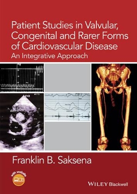 Patient Studies in Valvular, Congenital, and Rarer Forms of Cardiovascular Disease book