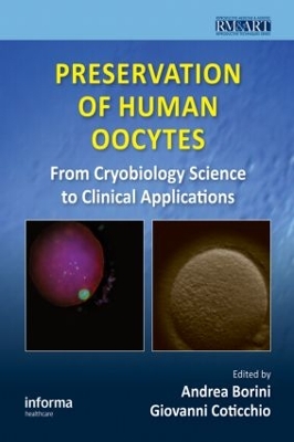 Preservation of Human Oocytes book