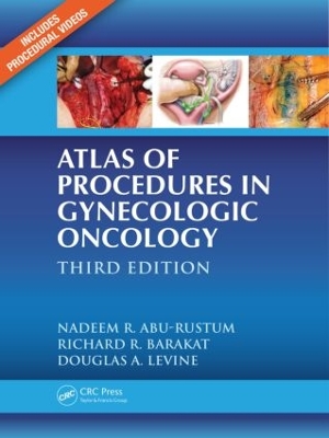 Atlas of Procedures in Gynecologic Oncology book