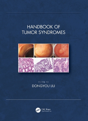 Handbook of Tumor Syndromes book