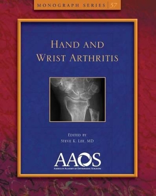 Hand and Wrist Arthritis book