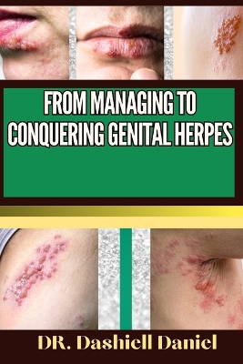 From Managing to Conquering Genital Herps: Expert Guide To Understanding the Causes, Recognizing Symptoms, Prevention and Embracing Effective Treatments for a Vibrant and Healthy Life book