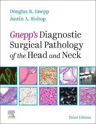 Gnepp's Diagnostic Surgical Pathology of the Head and Neck by Douglas R. Gnepp