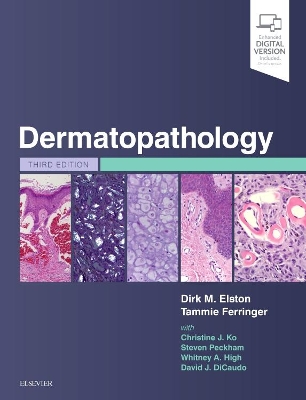 Dermatopathology by Dirk M. Elston