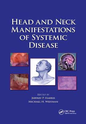 Head and Neck Manifestations of Systemic Disease by Jeffrey P. Harris