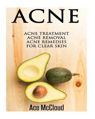 Acne: Acne Treatment- Acne Removal- Acne Remedies for Clear Skin by Ace McCloud