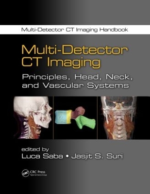 Multi-Detector CT Imaging book