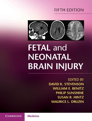 Fetal and Neonatal Brain Injury book