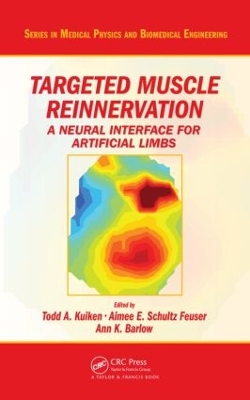 Targeted Muscle Reinnervation by Todd A. Kuiken