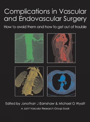 Complications in Vascular & Endovascular Surgery book