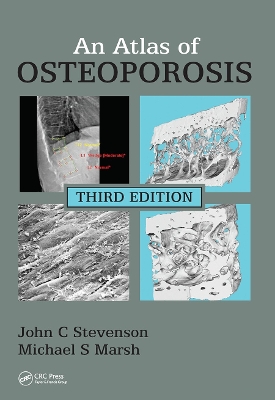 An Atlas of Osteoporosis book