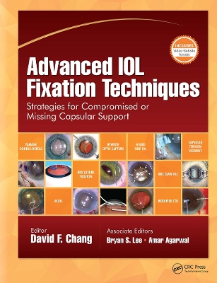 Advanced IOL Fixation Techniques: Strategies for Compromised or Missing Capsular Support book