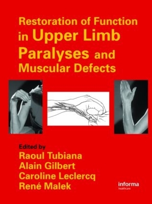 Restoration of Function in Upper Limb Paralyses and Muscular Defects by Raoul Tubiana