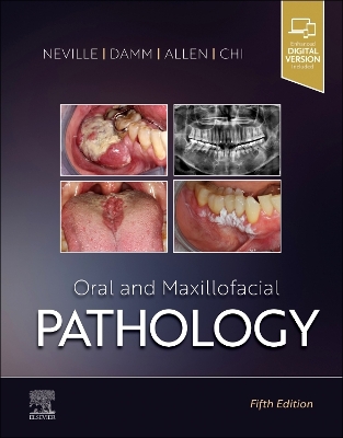 Oral and Maxillofacial Pathology book