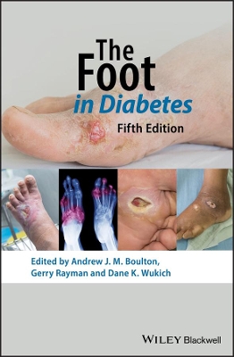 The Foot in Diabetes book