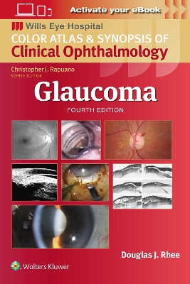 Glaucoma book