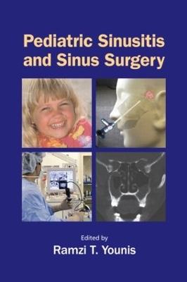 Pediatric Sinusitis and Sinus Surgery by Ramzi T. Younis