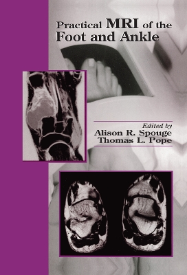 Practical MRI of the Foot and Ankle by Alison R. Spouge