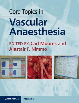 Core Topics in Vascular Anaesthesia book