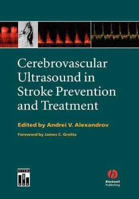 Cerebrovascular Ultrasound in Stroke Prevention and Treatment by Andrei V Alexandrov