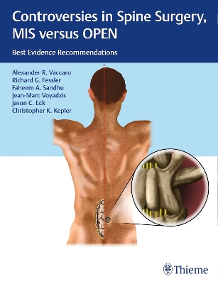 Controversies in Spine Surgery, MIS versus OPEN by Alexander R. Vaccaro