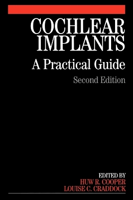 Cochlear Implants book