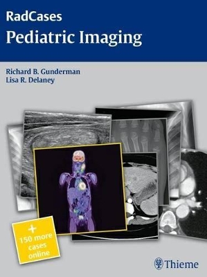 Radcases Pediatric Imaging book