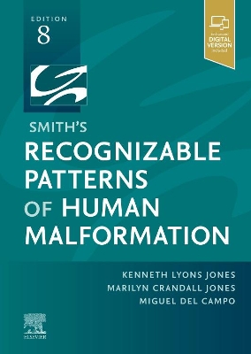 Smith's Recognizable Patterns of Human Malformation by Kenneth Lyons Jones