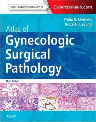 Atlas of Gynecologic Surgical Pathology by Philip B. Clement