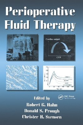 Perioperative Fluid Therapy by Robert G Hahn