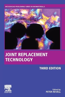 Joint Replacement Technology by Peter A. Revell