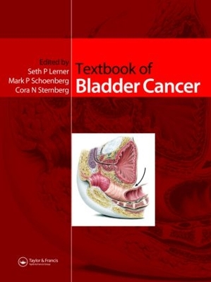 Textbook of Bladder Cancer by Seth P. Lerner