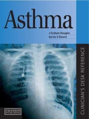 Asthma by J Douglas