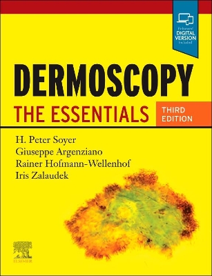 Dermoscopy: The Essentials book