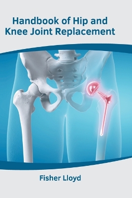 Handbook of Hip and Knee Joint Replacement book